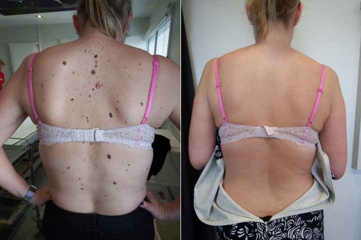 Before and after